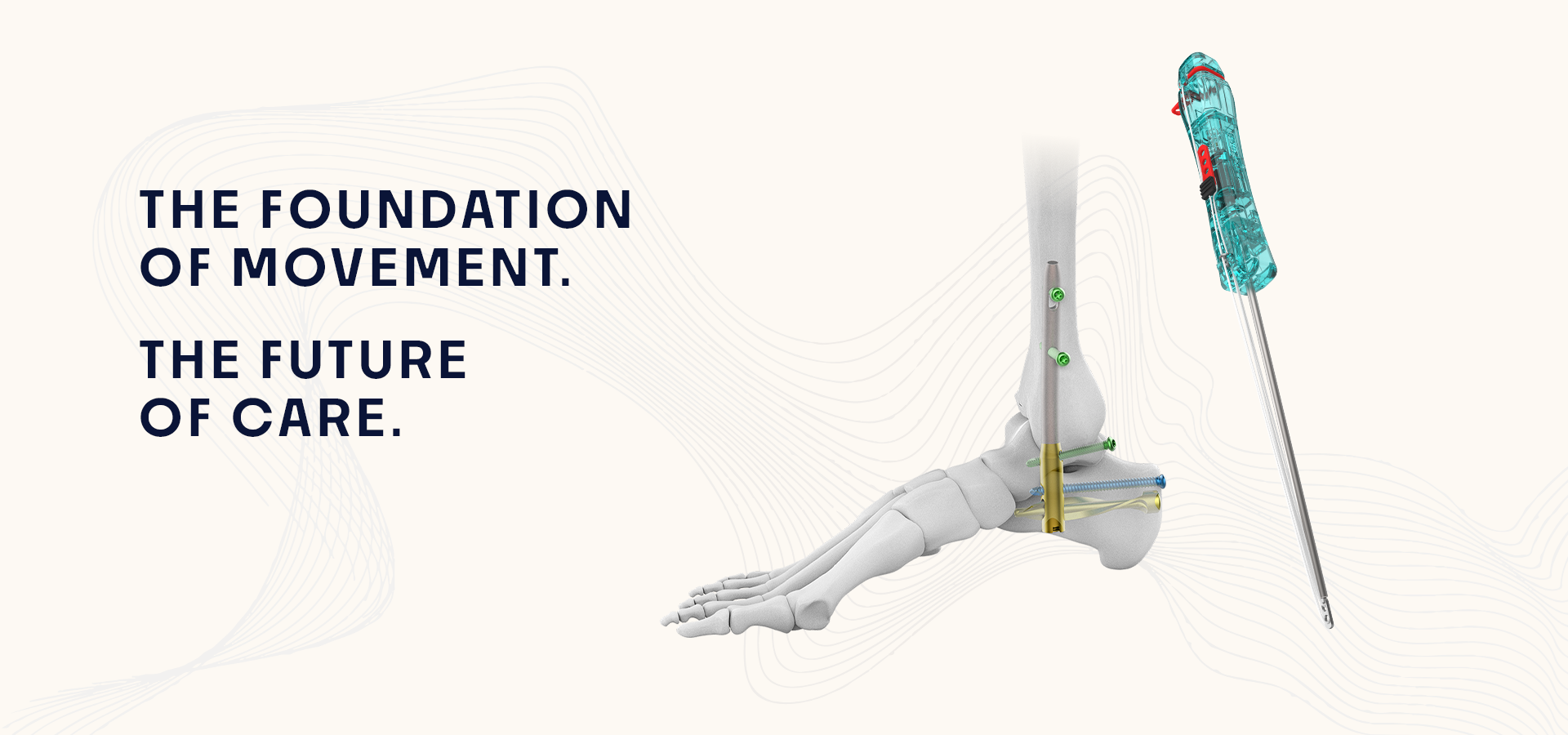 Banner showing a skeletal foot with ankle hardware next to a turquoise external fixator on a pale background, with the slogan 'The foundation of movement. The future of care.'