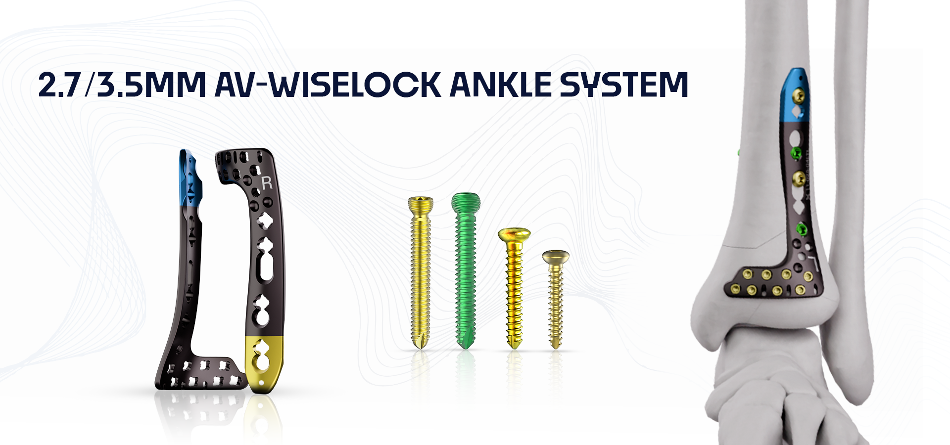 AV-WISELOCK ankle system components: plates and multiple screws displayed on a white background with a blue-accented plate on the left and a foot/ankle device on the right