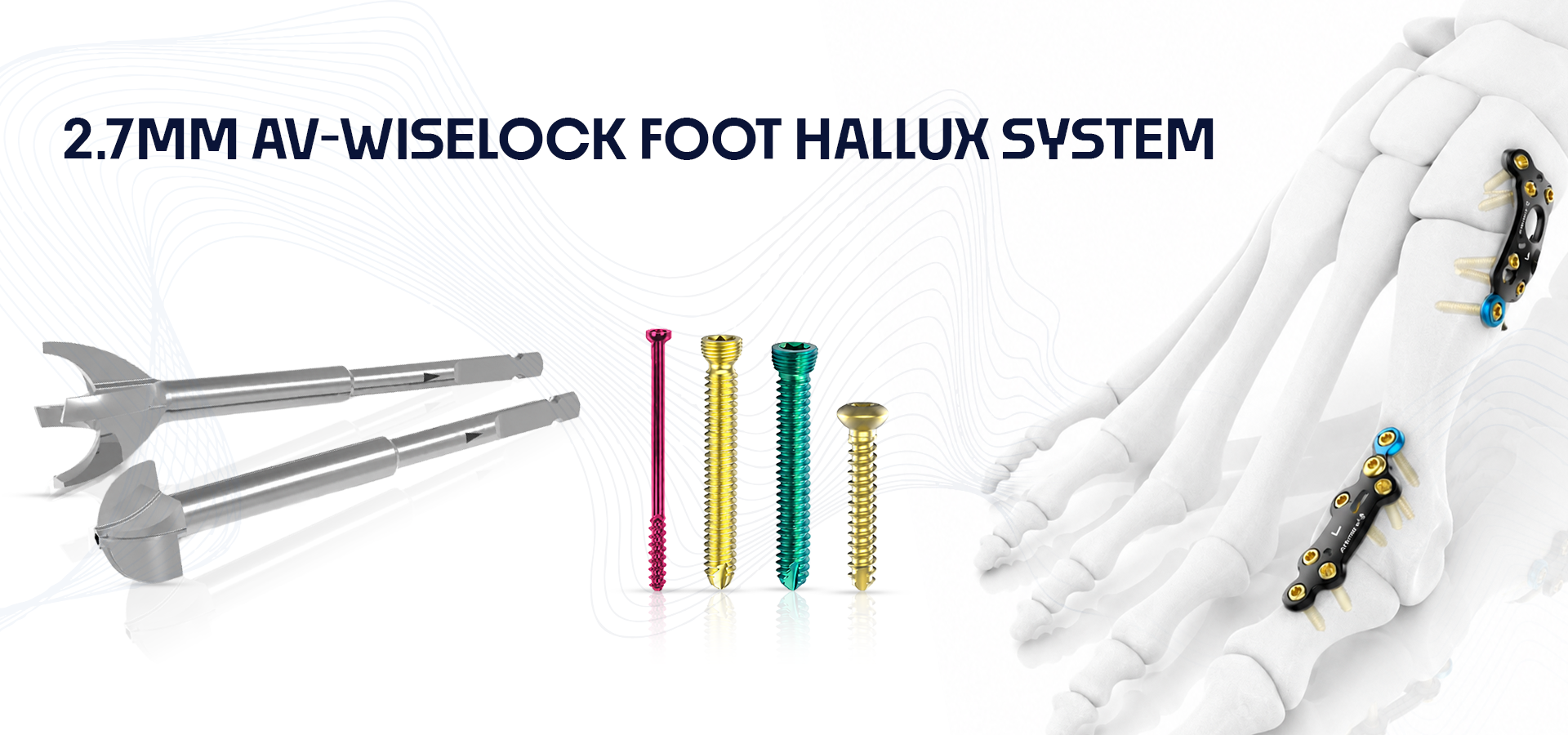 Image shows orthopedic foot implants for hallux system: assorted screws and pins with anatomically modeled foot/ankle hardware used for 2.7mm AV-WiseLock Foot Hallux System