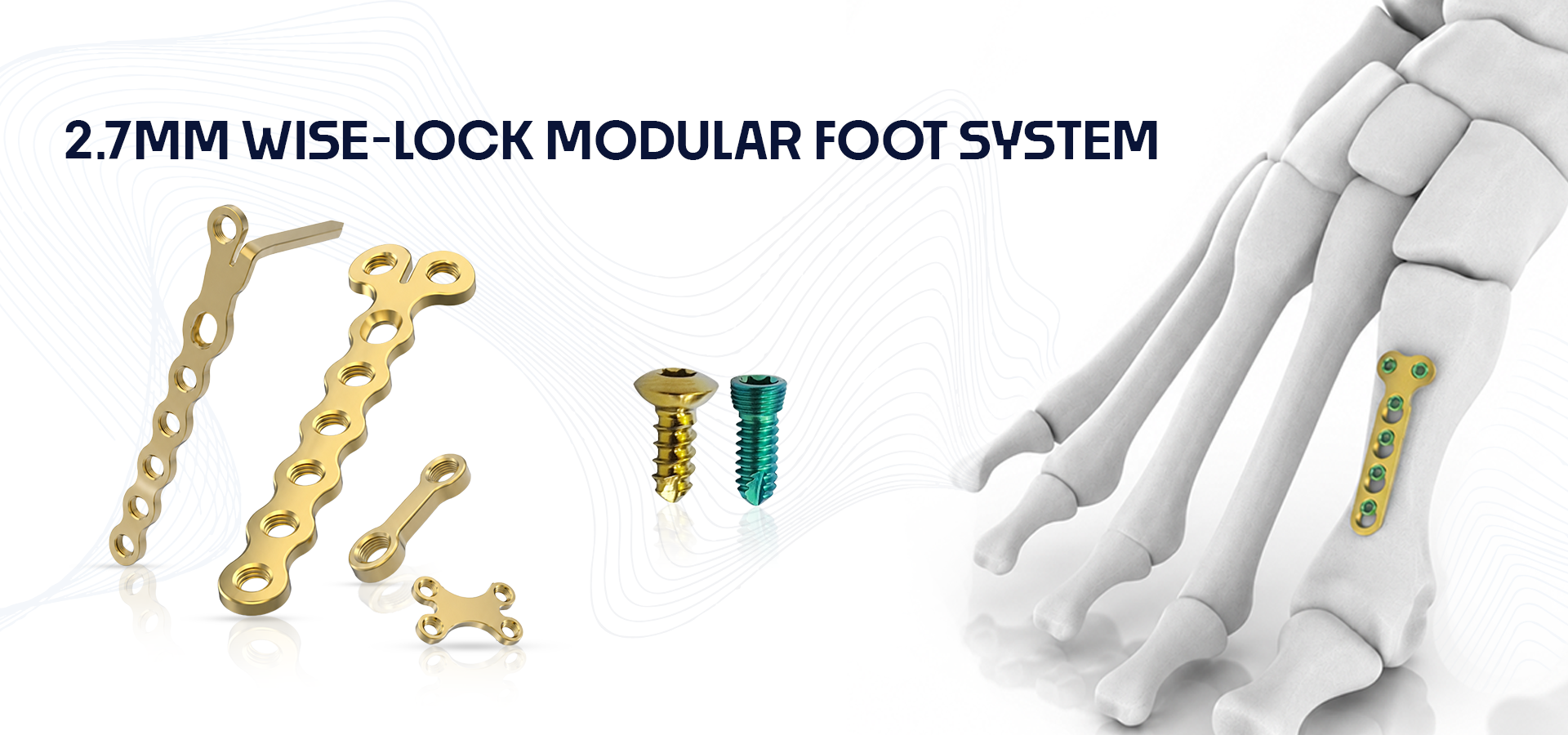 Illustration of the 2.7mm Wise-Lock modular foot system with gold plates, screws, and a skeletal foot model.