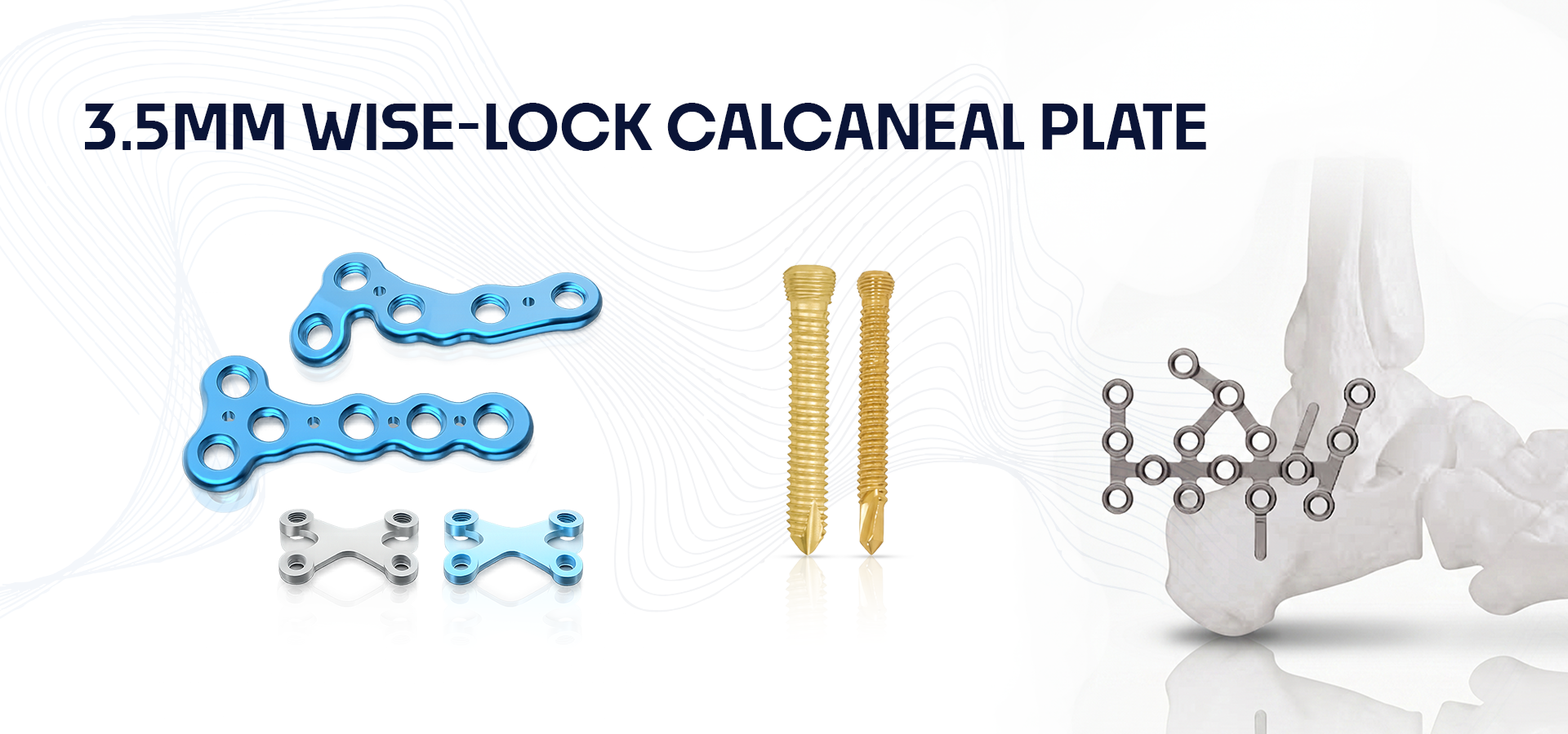 Blue 3.5 mm Wise-Lock calcaneal plates with screws and a calcaneus implant model for foot fracture fixation.
