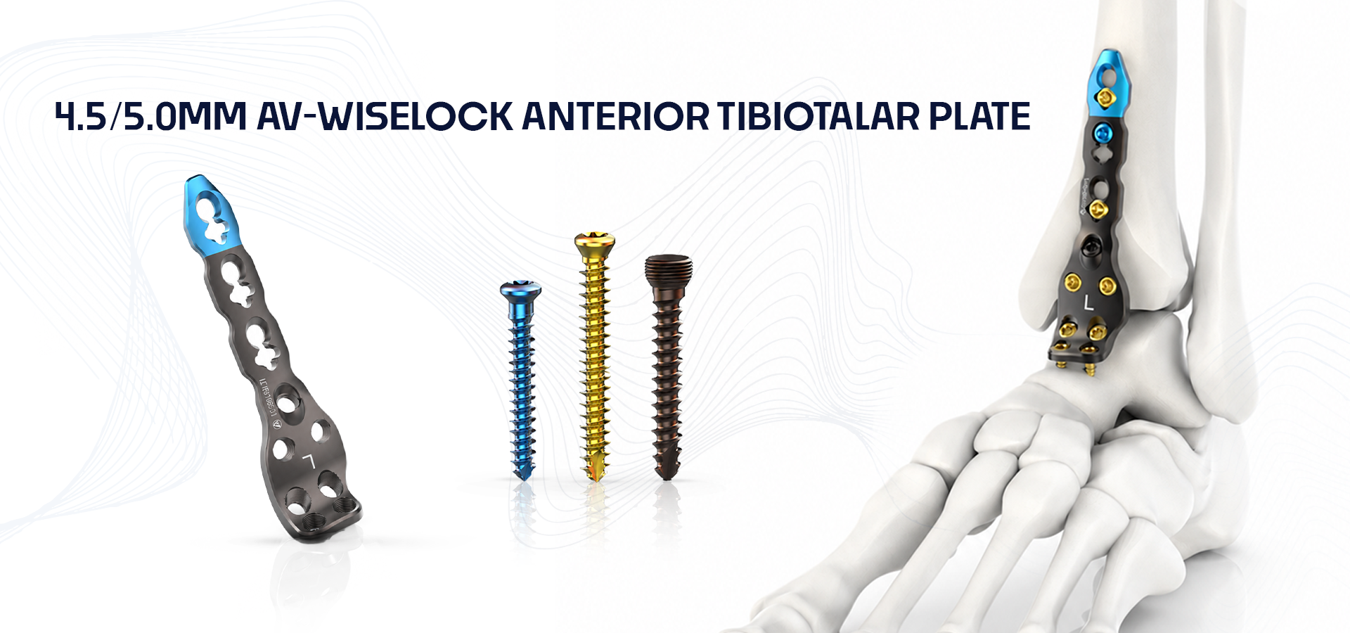 4.5/5.0 mm AV-WISELOCK anterior tibiotalar plate with blue, gold, and brown screws next to a foot and ankle bone model (orthopedic implant).
