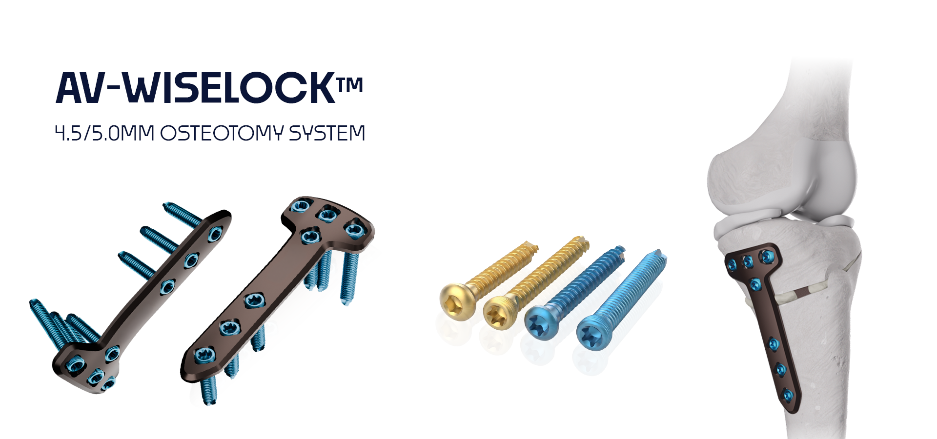 AV-WISELOCK 4.5/5.0mm osteotomy system components: plates and screws laid out beside a knee joint model that appears in the background.