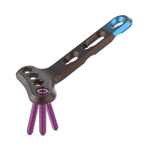 Orthopedic bone plate with multiple purple screws attached, designed for fracture fixation.