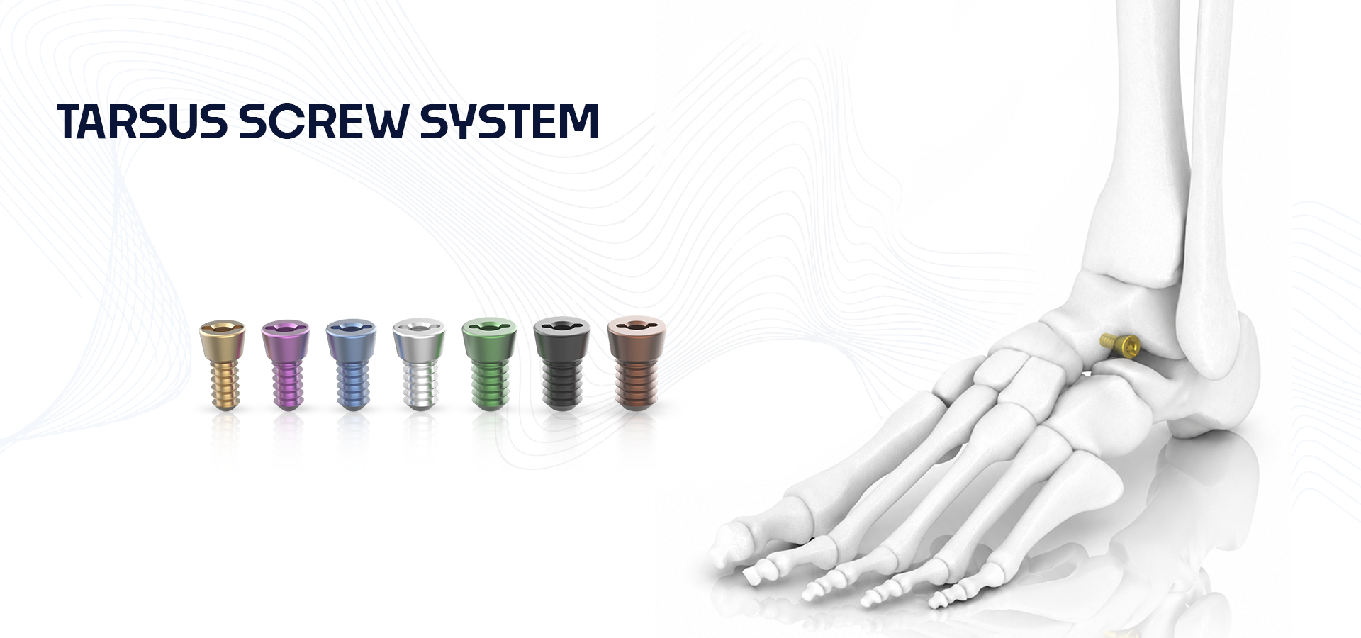Row of colorful dental implants on a white background with a skeletal foot showing an ankle implant on the right; header reads 'TARSUS SCREW SYSTEM'.
