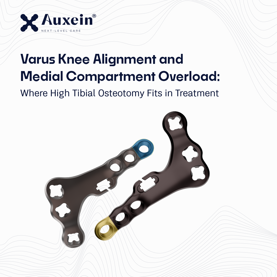 Hero image with two orthopedic knee implants (plates and screws) on a white background, accompanying an article about Varus Knee Alignment and Medial Compartment Overload.