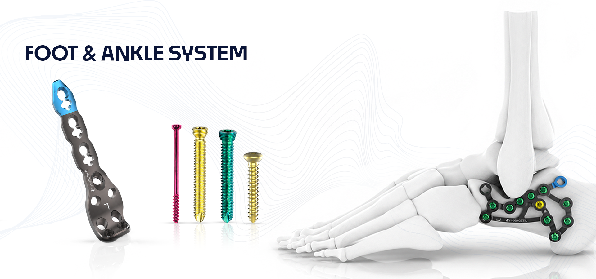 Foot and ankle surgical hardware with a curved gray plate on the left, four color-coded screws in the middle, and a skeletal foot with a hindfoot/ankle plate on the right against a white background.