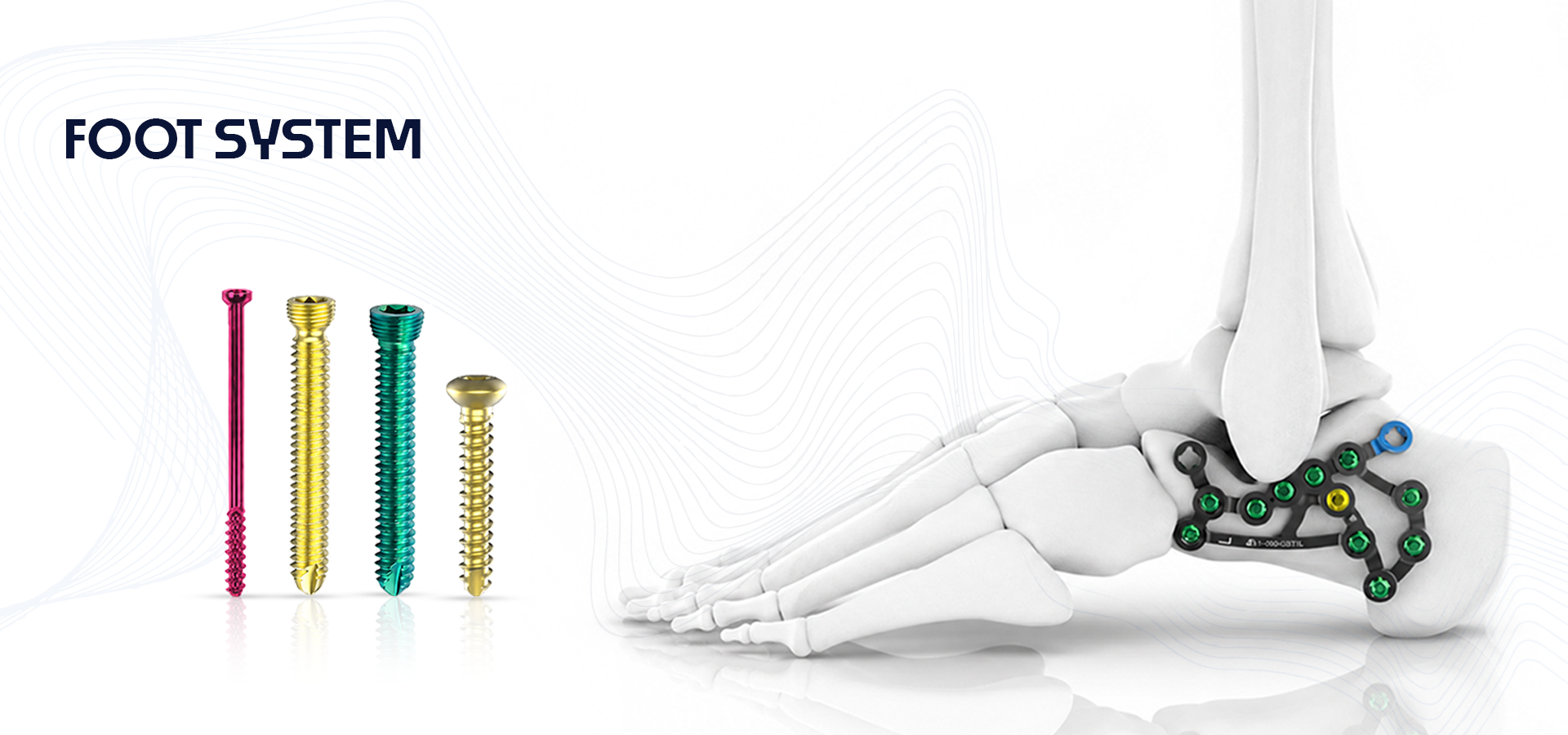 Brand banner for a foot system: four colored screws beside a skeletal foot with ankle implants.