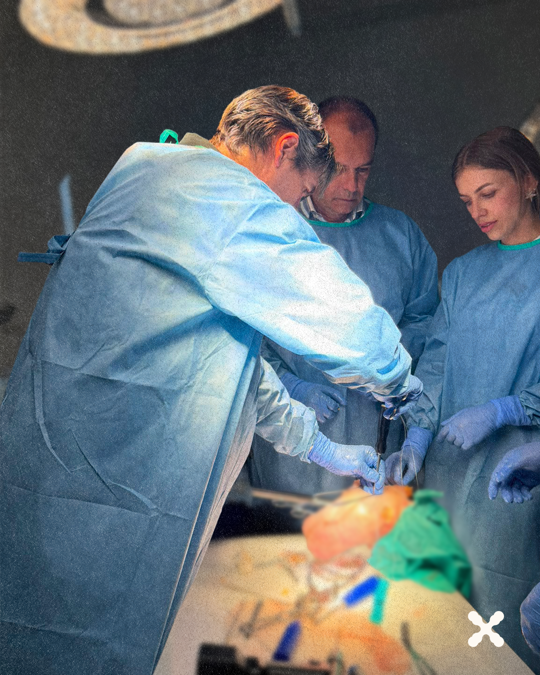 Surgeons in blue gowns and gloves perform a surgical procedure around a patient on the operating table in a sterile environment.