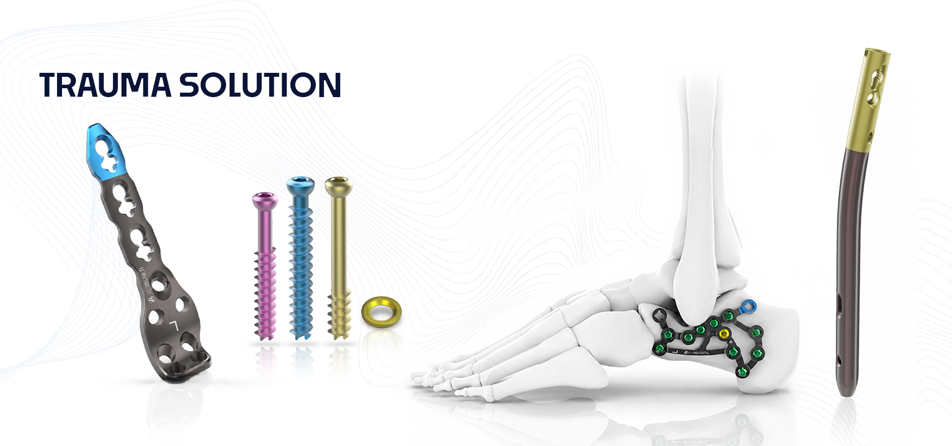 Orthopedic trauma implants (plates, screws, rings) with a skeletal foot showing fixation hardware.