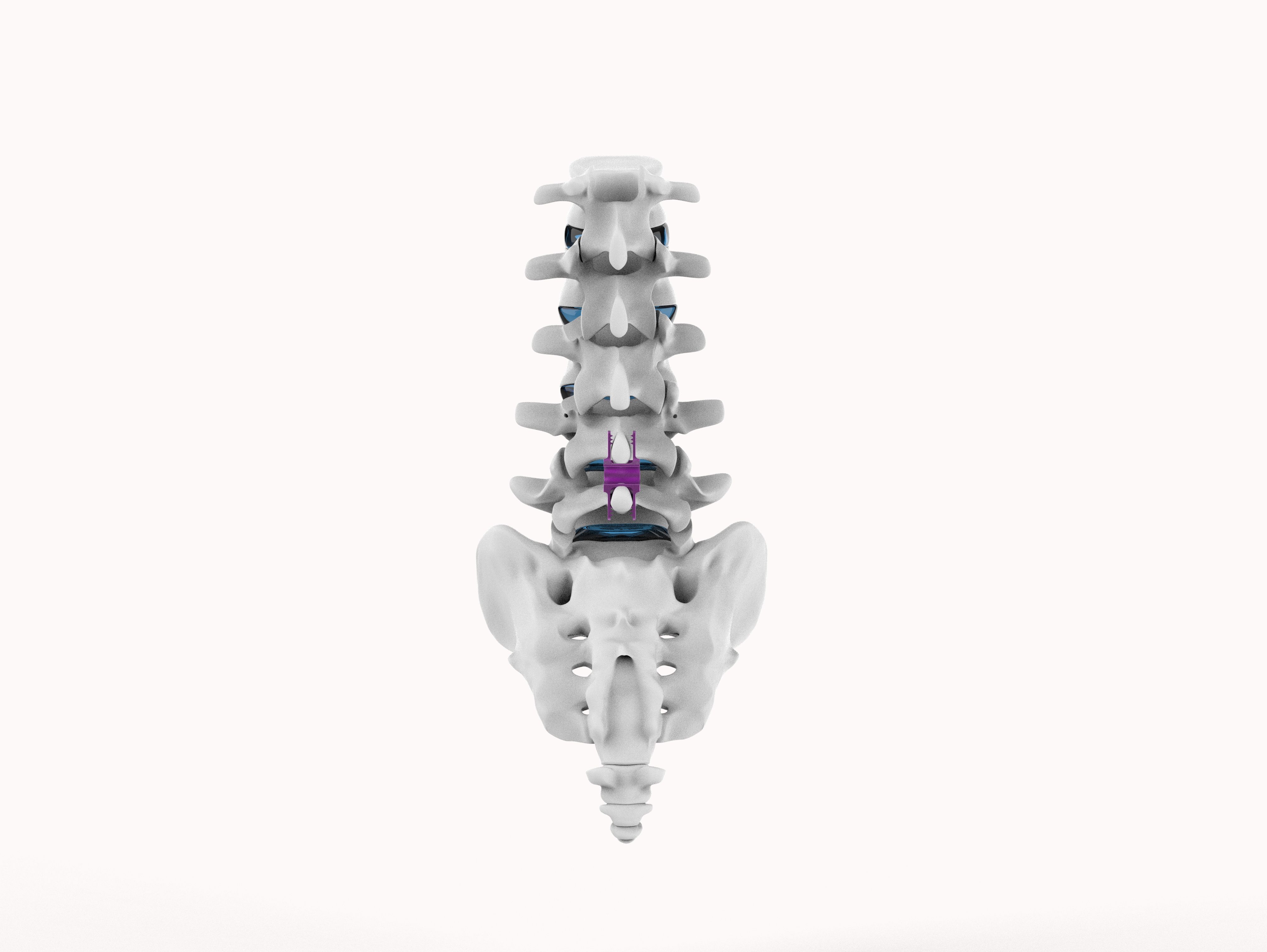 Ua spine 2025
